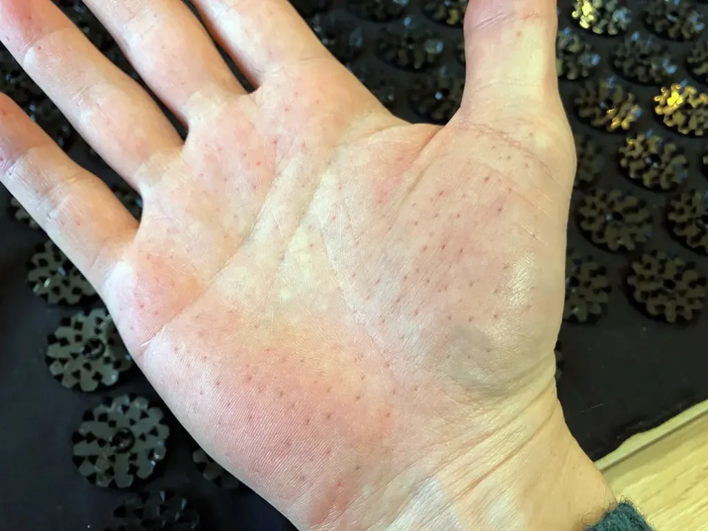 シャクティマットに手を押し当てた様子